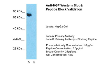 HGF Rabbit Polyclonal Antibody