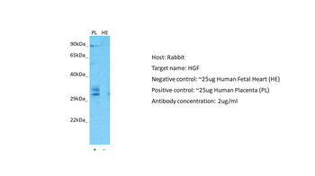 HGF Rabbit Polyclonal Antibody
