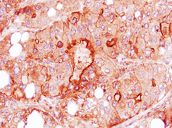 HGF Rabbit Polyclonal Antibody