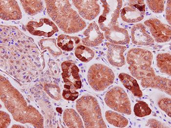 HGF Rabbit Polyclonal Antibody