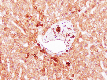 HGF Rabbit Polyclonal Antibody