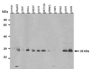 HGF Rabbit Polyclonal Antibody