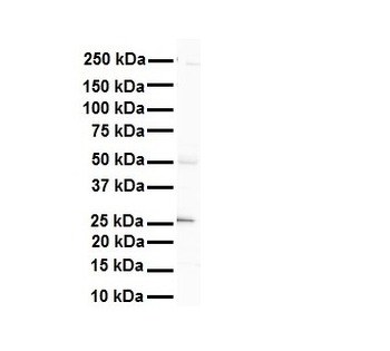 HGF Rabbit Polyclonal Antibody