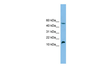 EPO Rabbit Polyclonal Antibody