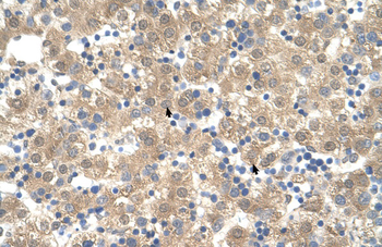 PPIB Rabbit Polyclonal Antibody