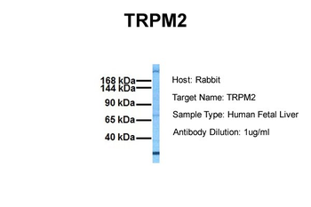 TRPM2 Rabbit Polyclonal Antibody