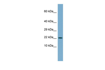 C4orf3 Rabbit Polyclonal Antibody