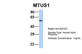 MTUS1 Rabbit Polyclonal Antibody