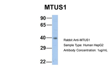 MTUS1 Rabbit Polyclonal Antibody