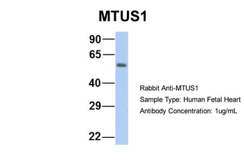 MTUS1 Rabbit Polyclonal Antibody
