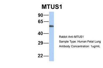 MTUS1 Rabbit Polyclonal Antibody
