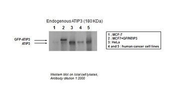 MTUS1 Rabbit Polyclonal Antibody
