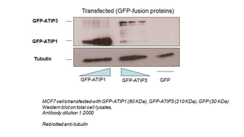 MTUS1 Rabbit Polyclonal Antibody