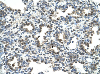 GPNMB Rabbit Polyclonal Antibody