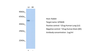 GPNMB Rabbit Polyclonal Antibody