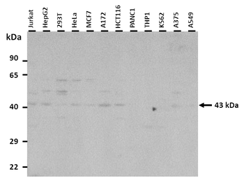 GP2 Rabbit Polyclonal Antibody