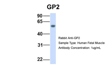 GP2 Rabbit Polyclonal Antibody