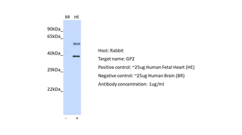 GP2 Rabbit Polyclonal Antibody