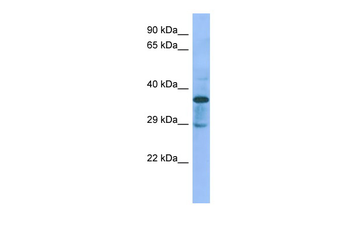 C1galt1c1 Rabbit Polyclonal Antibody