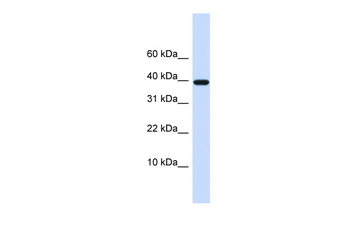 CNMD Rabbit Polyclonal Antibody