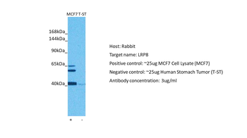 LRP8 Rabbit Polyclonal Antibody