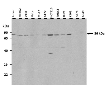 CPT1A Rabbit Polyclonal Antibody