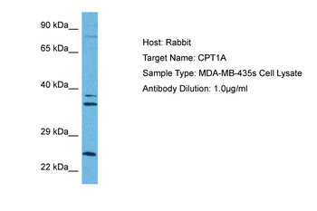 CPT1A Rabbit Polyclonal Antibody