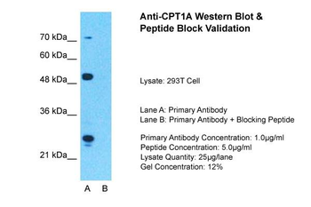 CPT1A Rabbit Polyclonal Antibody