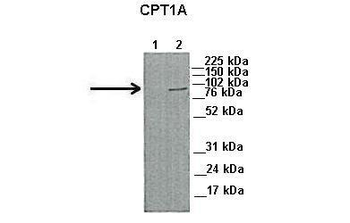 CPT1A Rabbit Polyclonal Antibody