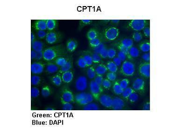 CPT1A Rabbit Polyclonal Antibody