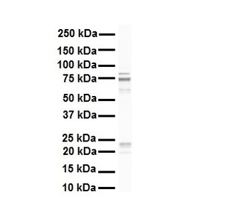 RHOT1 Rabbit Polyclonal Antibody