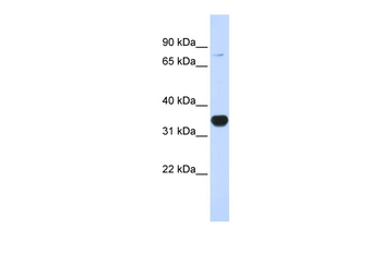 RHOT1 Rabbit Polyclonal Antibody