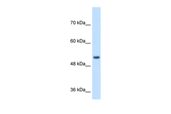 SPPL2B Rabbit Polyclonal Antibody