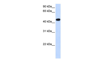 AADAC Rabbit Polyclonal Antibody