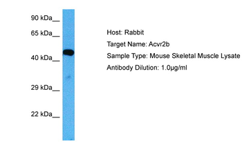 ACVR2B Rabbit Polyclonal Antibody