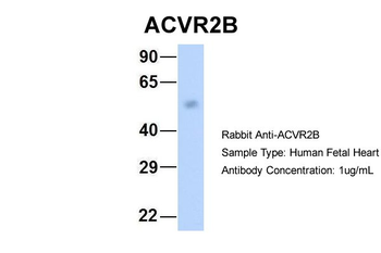 ACVR2B Rabbit Polyclonal Antibody