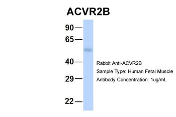ACVR2B Rabbit Polyclonal Antibody