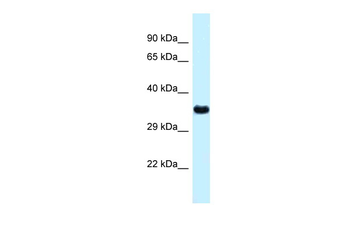 Ctsz Rabbit Polyclonal Antibody
