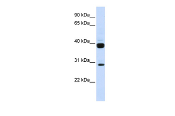 FLT3LG Rabbit Polyclonal Antibody