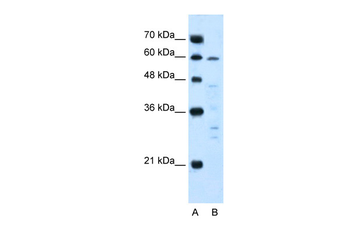 IL10RA Rabbit Polyclonal Antibody