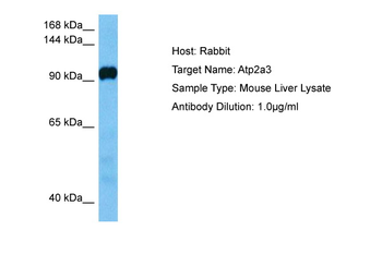 ATP2A2 Rabbit Polyclonal Antibody