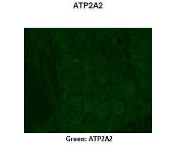 ATP2A2 Rabbit Polyclonal Antibody