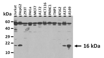ATP6V0C Rabbit Polyclonal Antibody
