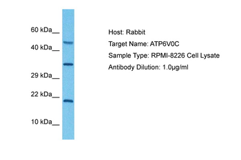 ATP6V0C Rabbit Polyclonal Antibody