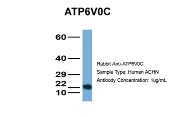 ATP6V0C Rabbit Polyclonal Antibody