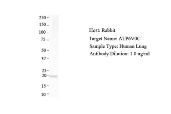 ATP6V0C Rabbit Polyclonal Antibody