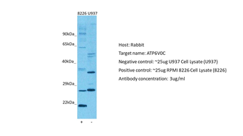 ATP6V0C Rabbit Polyclonal Antibody