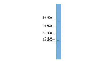 ATP6V0C Rabbit Polyclonal Antibody