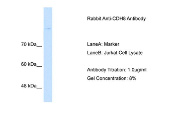 CDH8 Rabbit Polyclonal Antibody