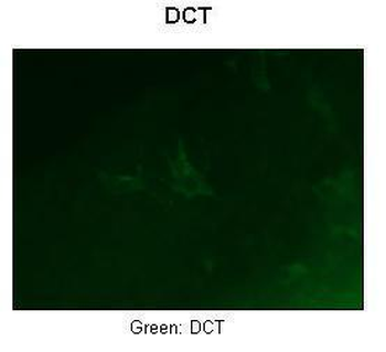 Dct Rabbit Polyclonal Antibody